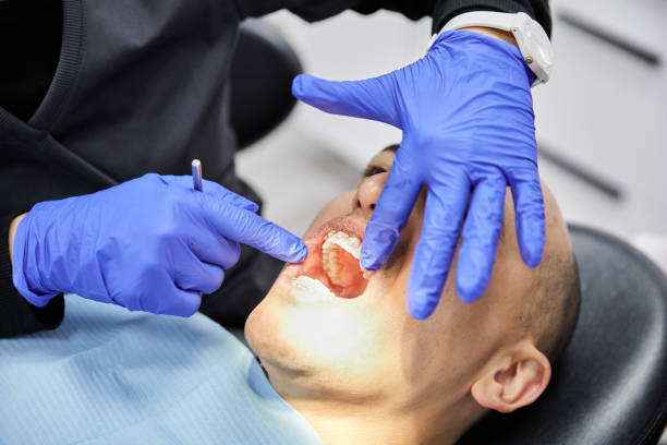 Best Emergency Root Canal Treatment in Acworth, GA